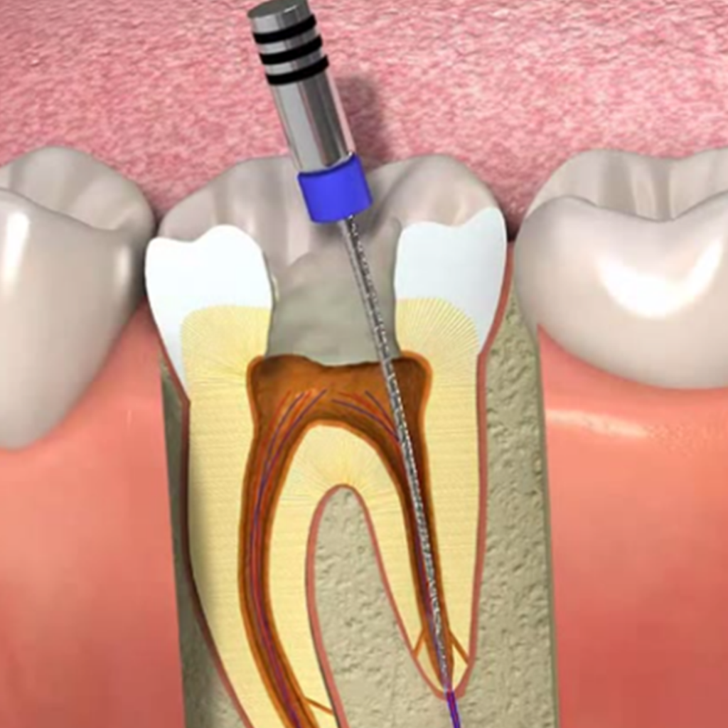 Endodontia-1024×1024